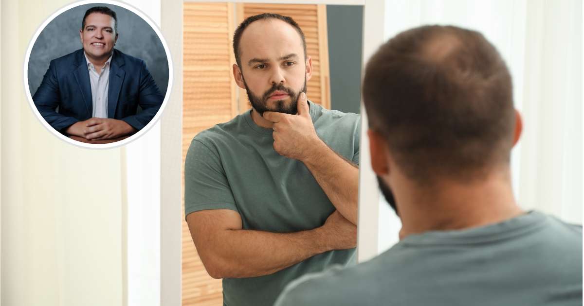 A calvície não começa quando o cabelo cai. Ela começa quando você muda seus hábitos