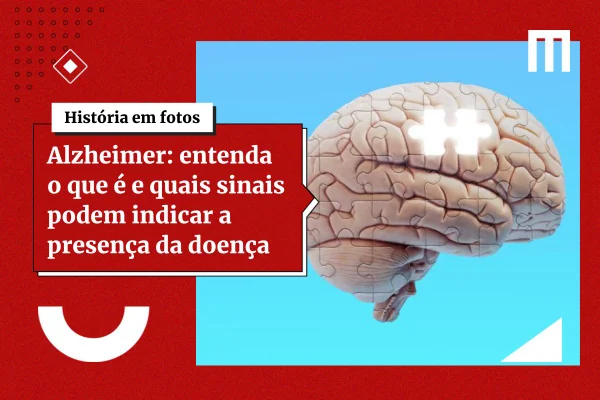 Estimulação cognitiva pode retardar perda de funções no Alzheimer - destaque galeria