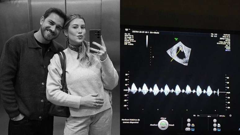 Niina Secrets revela perda de bebê: ‘Dor e uma tristeza no coração’