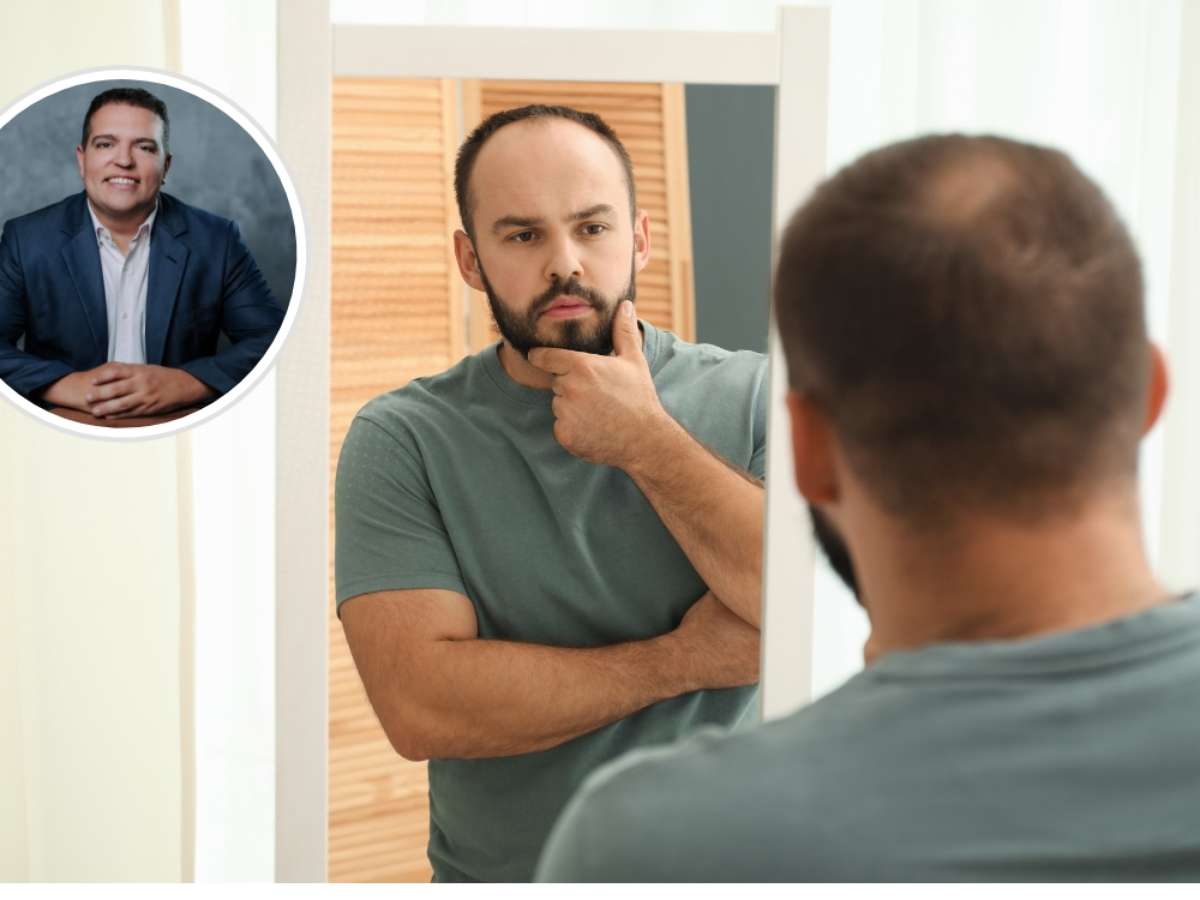 A calvície não começa quando o cabelo cai. Ela começa quando você muda seus hábitos
