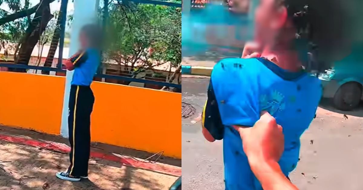 Após mais de 100 ferroadas, menina pode receber alta neste fim de semana na Grande BH