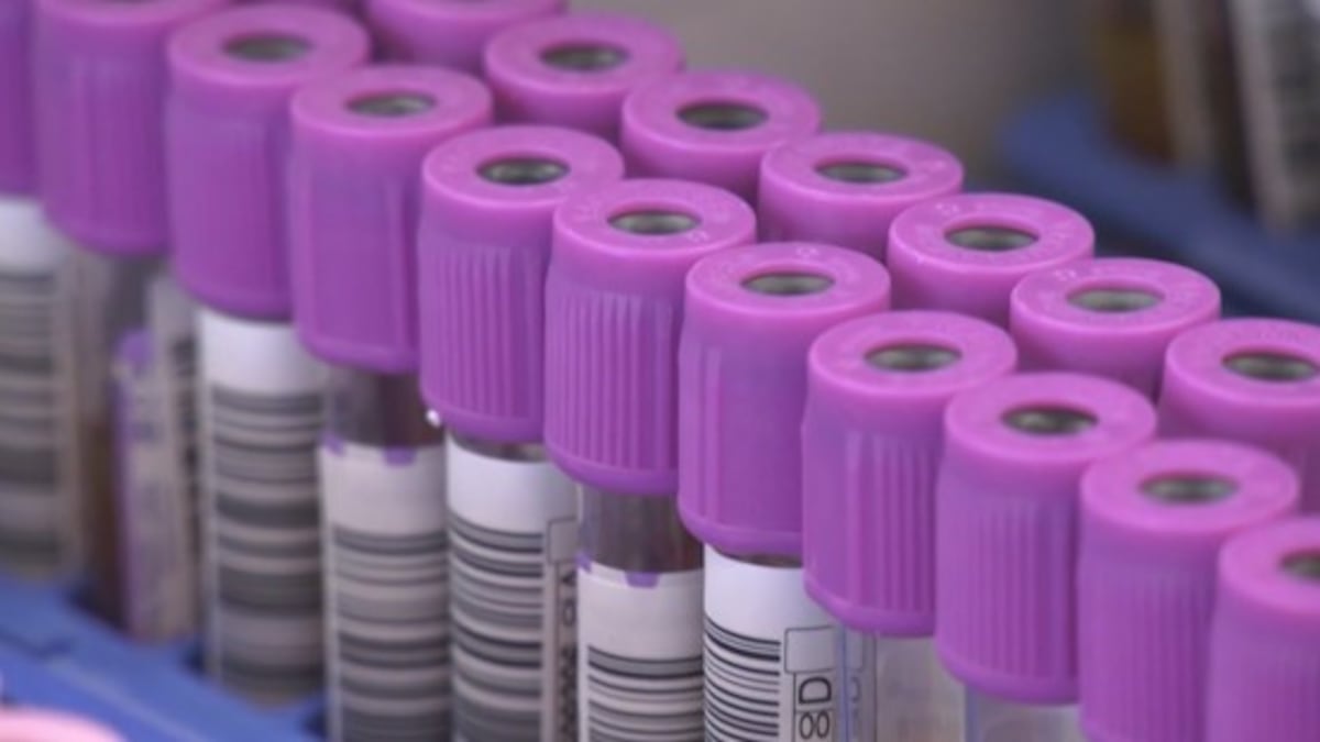 Calgary doctor highlights plasma needs amid safety concerns at clinics